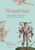 Wound Man: The Many Lives of a Surgical Image - Hardcover