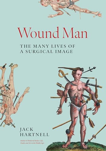 Wound Man: The Many Lives of a Surgical Image - Hardcover