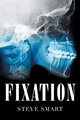 Fixation - Paperback