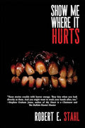 Show Me Where It Hurts - Paperback