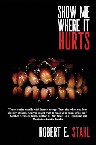 Show Me Where It Hurts - Paperback
