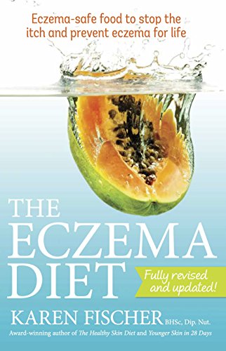 Eczema Diet: Eczema-Safe Food to Stop the Itch and Prevent Eczema for Life - Paperback