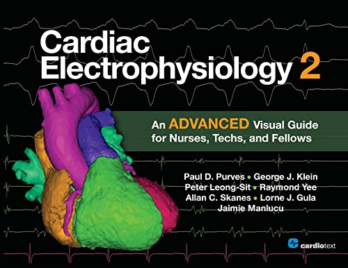 Cardiac Electrophysiology 2: An Advanced Visual Guide for Nurses, Techs, and Fellows: An Advanced Visual Guide for Nurses, Techs, and Fellows - Paperback
