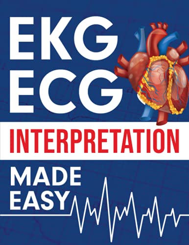 EKG ECG Interpretation Made Easy - Paperback