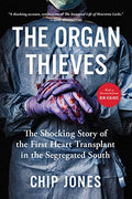 The Organ Thieves: The Shocking Story of the First Heart Transplant in the Segregated South - Paperback